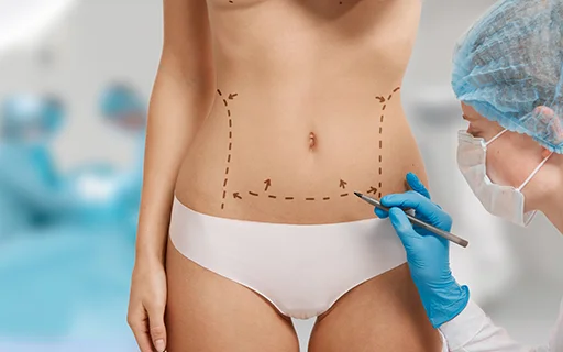 Endolifting en Abdomen