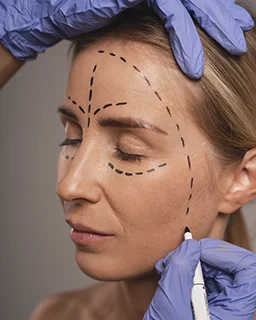 preparación para Endolifting facial
